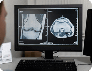 Knee Osteoarthritis Injections and Minimally Invasive Alternatives